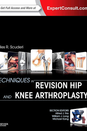 Techniques in Revision Hip and Knee Arthroplasty