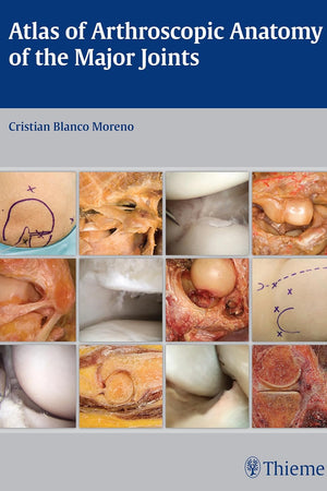 Atlas of Arthroscopic Anatomy of the Major Joints