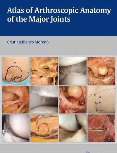 Atlas of Arthroscopic Anatomy of the Major Joints