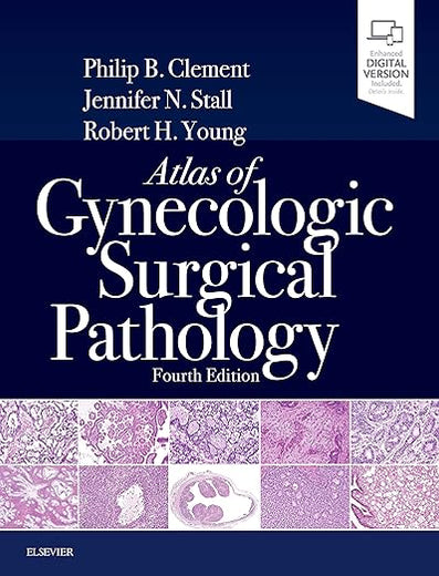 Atlas of Gynecologic Surgical Pathology: Expert Consult: Online and Print