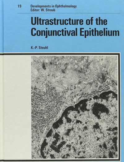 The Ultrastructure of the Conjunctival Epithelium (Developments in Ophthalmology)