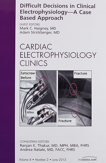 Difficult Decisions in Clinical Electrophysiology - A Case Based Approach, An Issue of Cardiac Electrophysiology Clinics (Volume 4-2) (The Clinics: Internal Medicine, Volume 4-2)